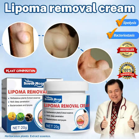 South Moon Lipoma Removal Cream (IMPORTED)